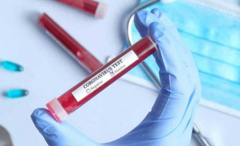 За минувшие сутки выявлено 296 новых случаев заражения коронавирусом