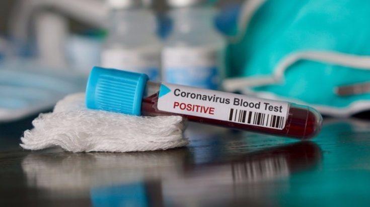 За минувшие сутки выявлено 112 новых случаев заражения коронавирусом