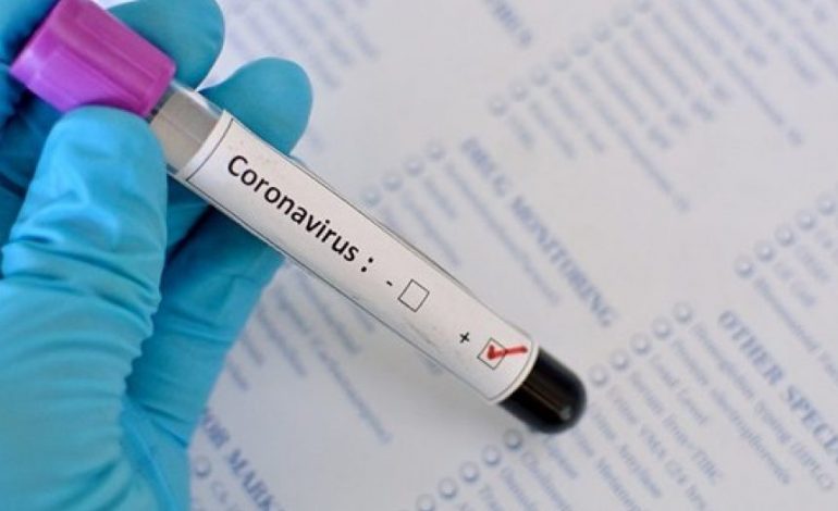 В Армении за сутки выявлено 134 новых случая заражения коронавирусом