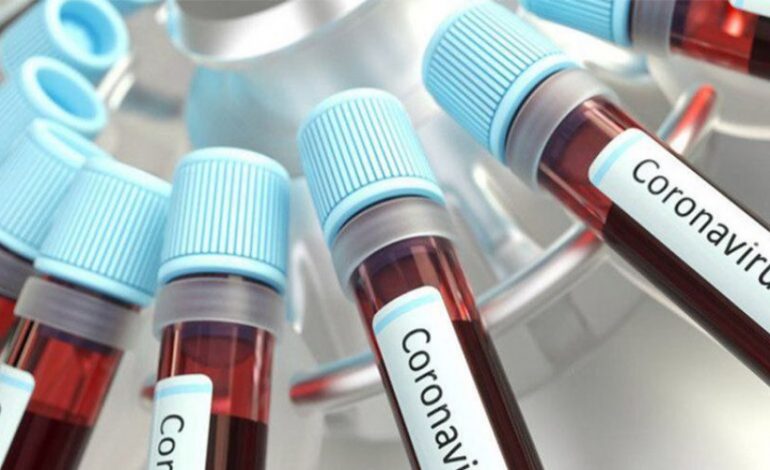 В Армении число регистрируемых за день случаев летальных исходов от коронавируса ползет вверх